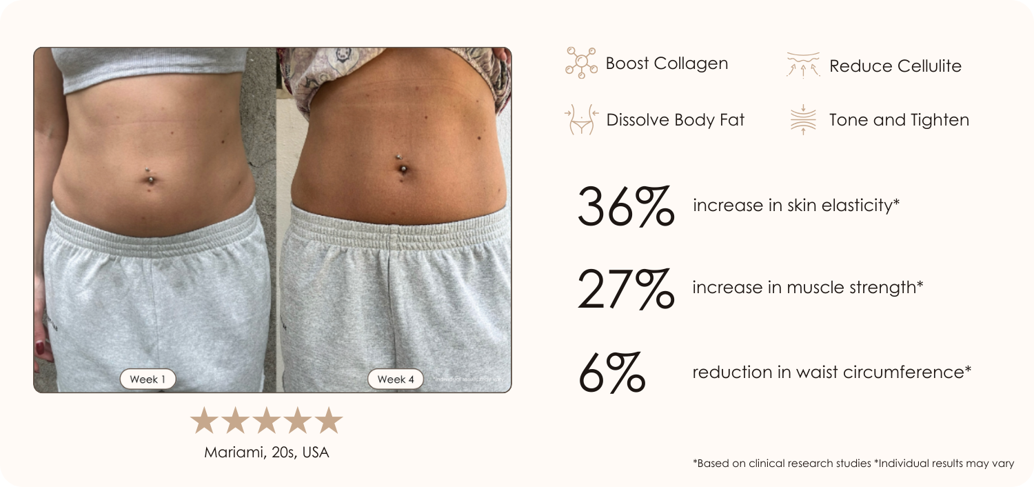 SERA Vacuum Body Contour before and after results showing tighter slimmer abdomen