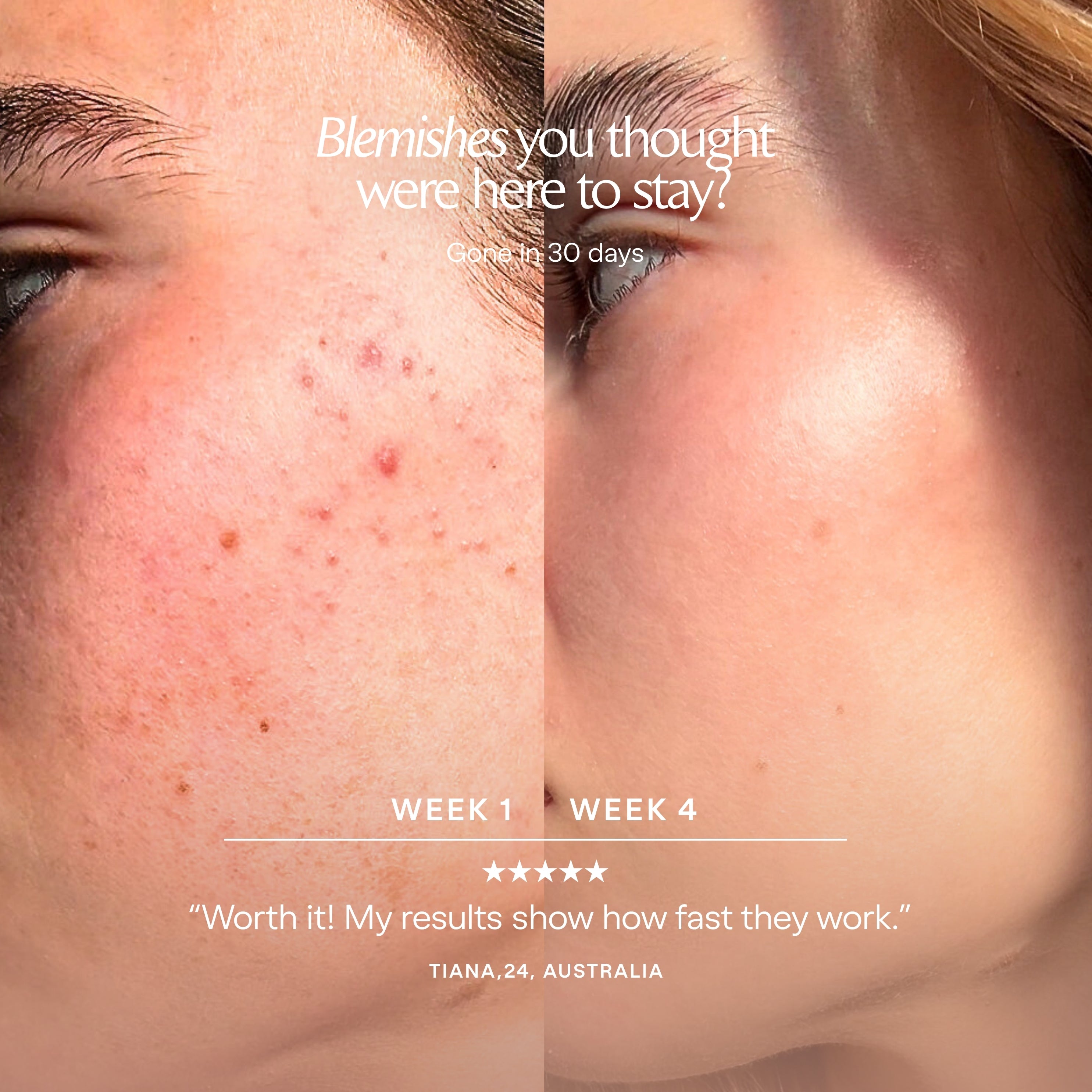 LumaLux Dome | Face & Body LED Red Light Therapy Device - Project E Beauty