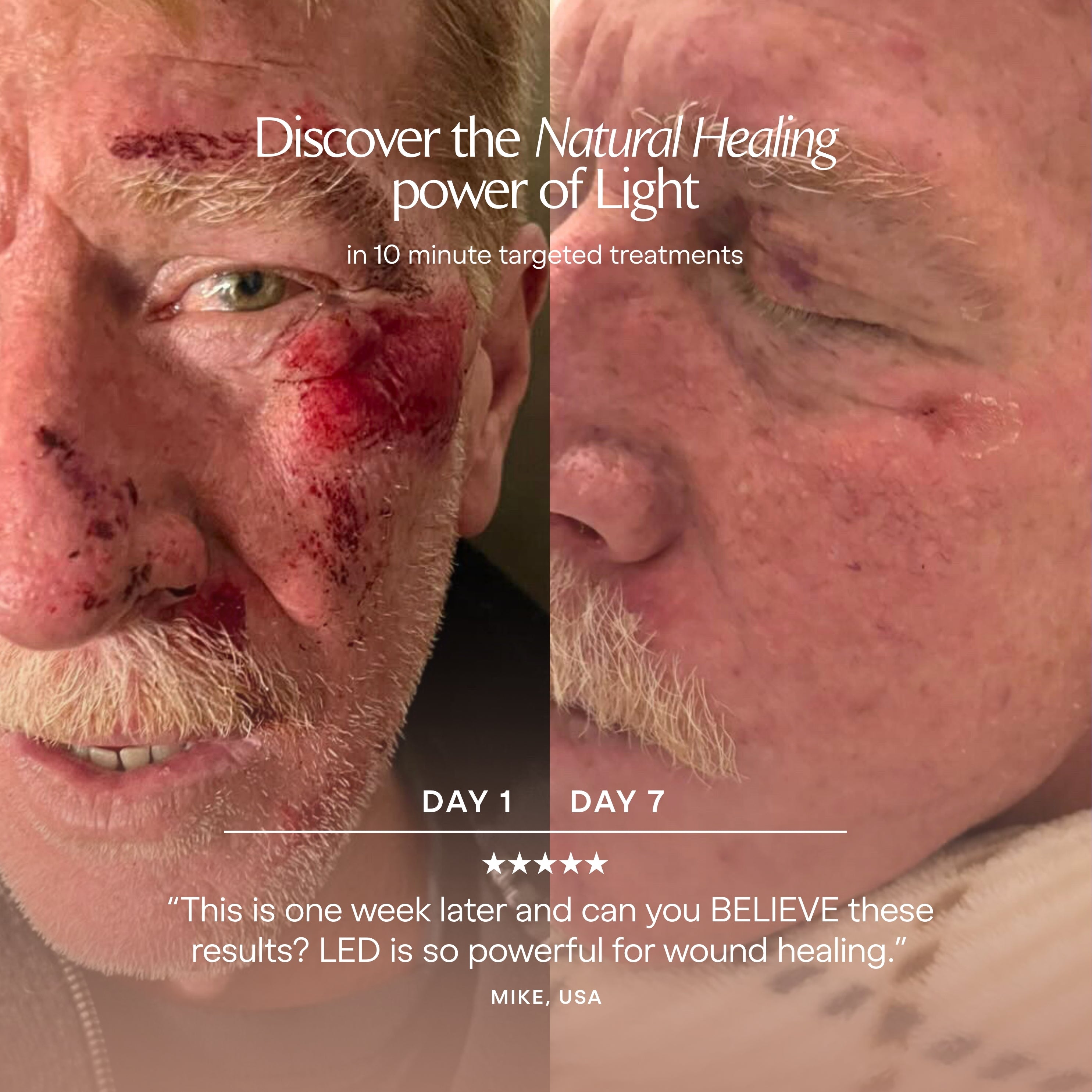 LumaLux Dome | Face & Body LED Red Light Therapy Device - Project E Beauty